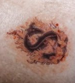 le tatouage des Skinner